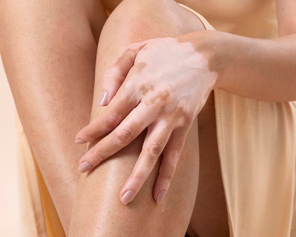 Dermatologisch getestet – warum das für unsere Produkte so wichtig ist