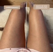 Vorher-Nachher-Vergleich der Beine einer Kundin: links unbehandelt, rechts nach 20 Minuten in mehreren Durchgängen mit dem EMS & Light Therapy Device und dem LymphGlow Leg Serum von The House of Legs
