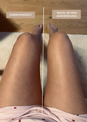 Vorher-Nachher-Vergleich der Beine einer Kundin: links unbehandelt, rechts nach 20 Minuten Anwendung mit LymphGlow Leg Serum und EMS-Gerät von The House of Legs